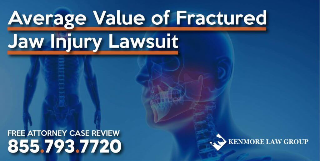 Average Value of Fractured Jaw Injury Lawsuit lawyer attorney sue compensation