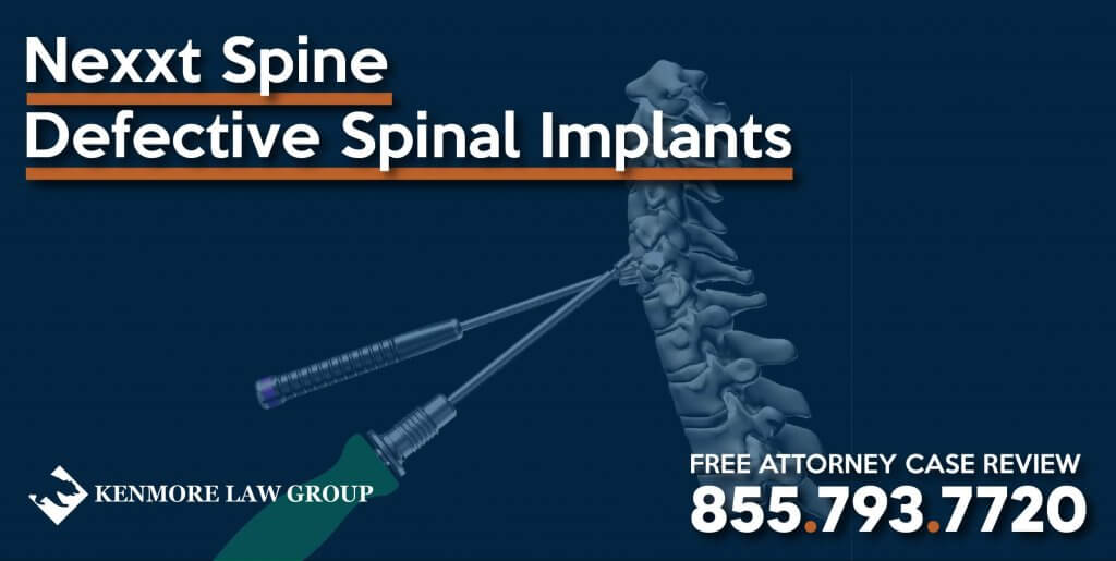 Nexxt Spine Defective Spinal Implants surgery defect improper malpractice surgeon corrosion lawyer attorney sue