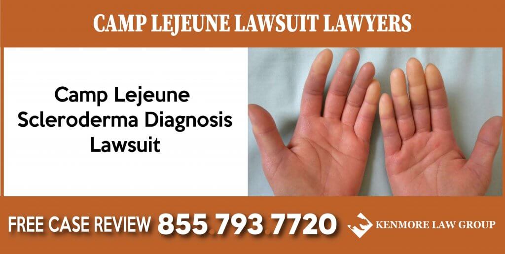 Lawyer for Camp Lejeune Scleroderma Diagnosis Lawsuit lawyer attorney sue compensation