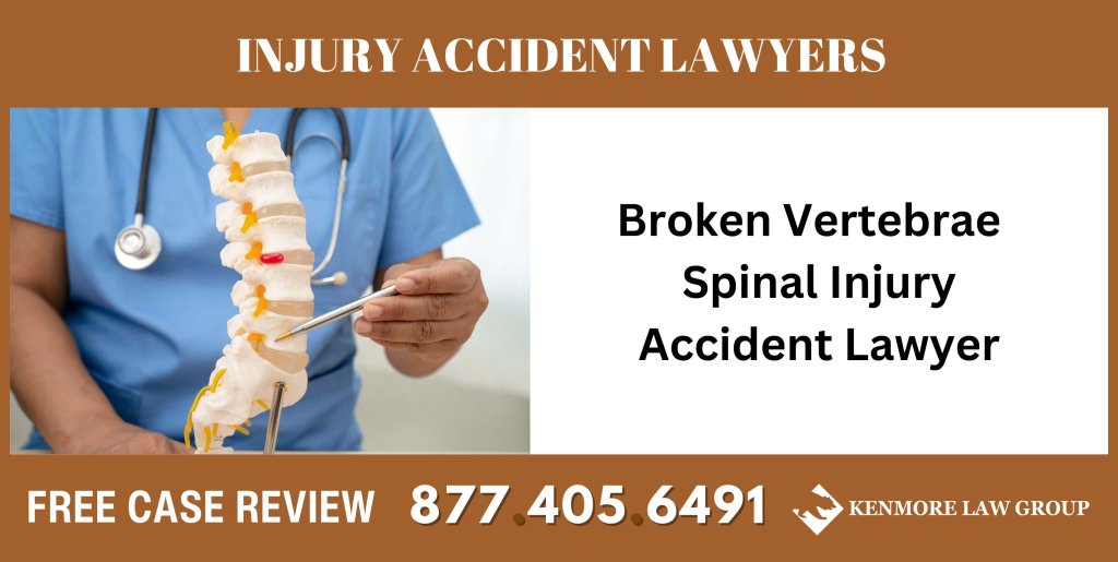 Broken Vertebrae - Spinal Injury Accident Lawyer sue liable incident attorney