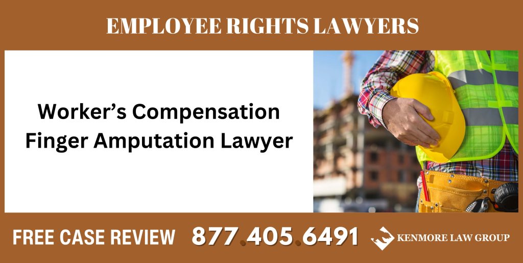 Worker’s Compensation Finger Amputation Lawyer sue liable incident attorney